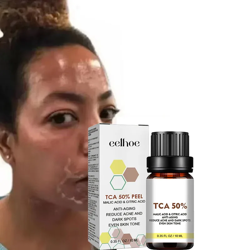 

¹ ᵁˢᴰ Acid Peeling Serum Chemical Exfoliant Peel for remove Face Dark Skin Spots Whiten Lighten Melanin Peeling Solution Skin P