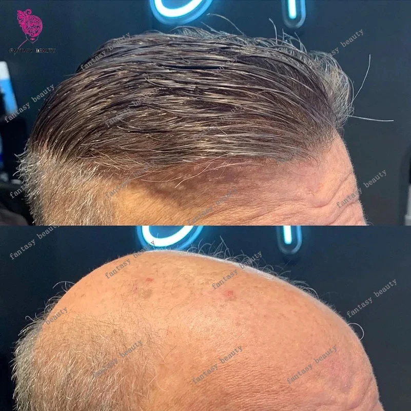 0.02 مللي متر جلد رقيق للغاية للرجال شعر بشري منخفض 80% الكثافة نظام Vloop 230 #   أبيض رمادي فضي 1B80 شعر مستعار طبيعي