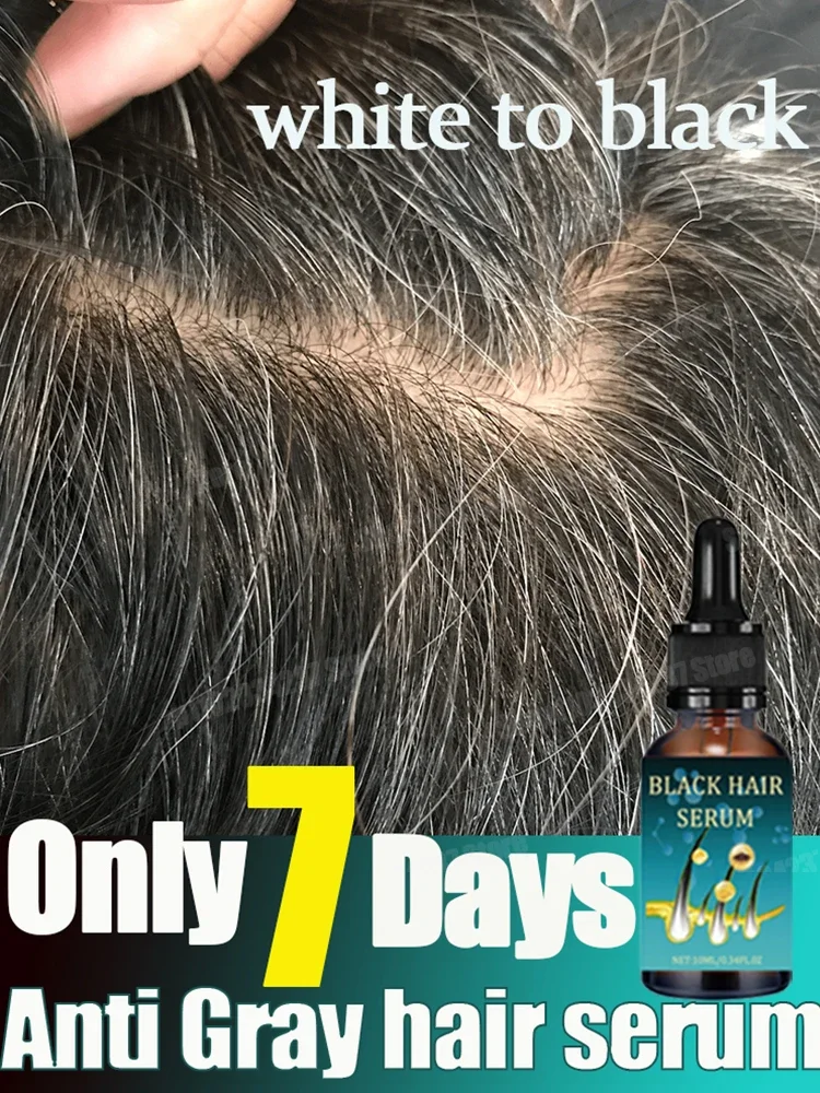 

Gray White Hair Serum Liquid White To Black Natural Color Repair turns white into black, and prevents gray Men Women