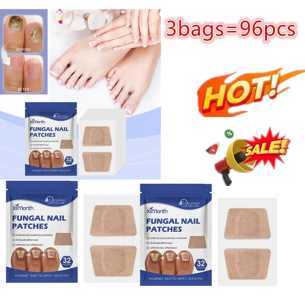 

3bags Paronychia Treatment Patch Fungus Removal Nail Correction Stickers Ingrown Nails Recover Pedicure Tools Repair Patch