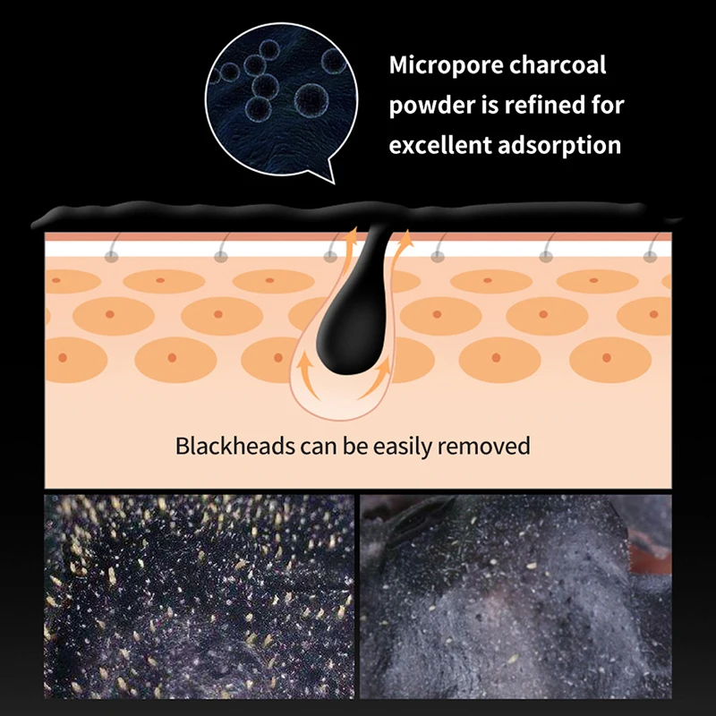 قناع مزيل الرؤوس السوداء تقليص المسام التنظيف العميق قناع ترطيب تحسين مسام الجلد الخام تقشر قناع الطين العناية بالبشرة