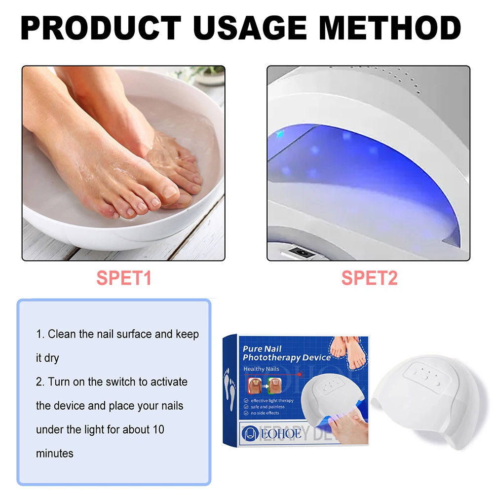 Nail Fungus Cleaning  Device Effective Home Use Nail-Fungus Remover Nail Fungus  Therapy Device for Onychomycosis