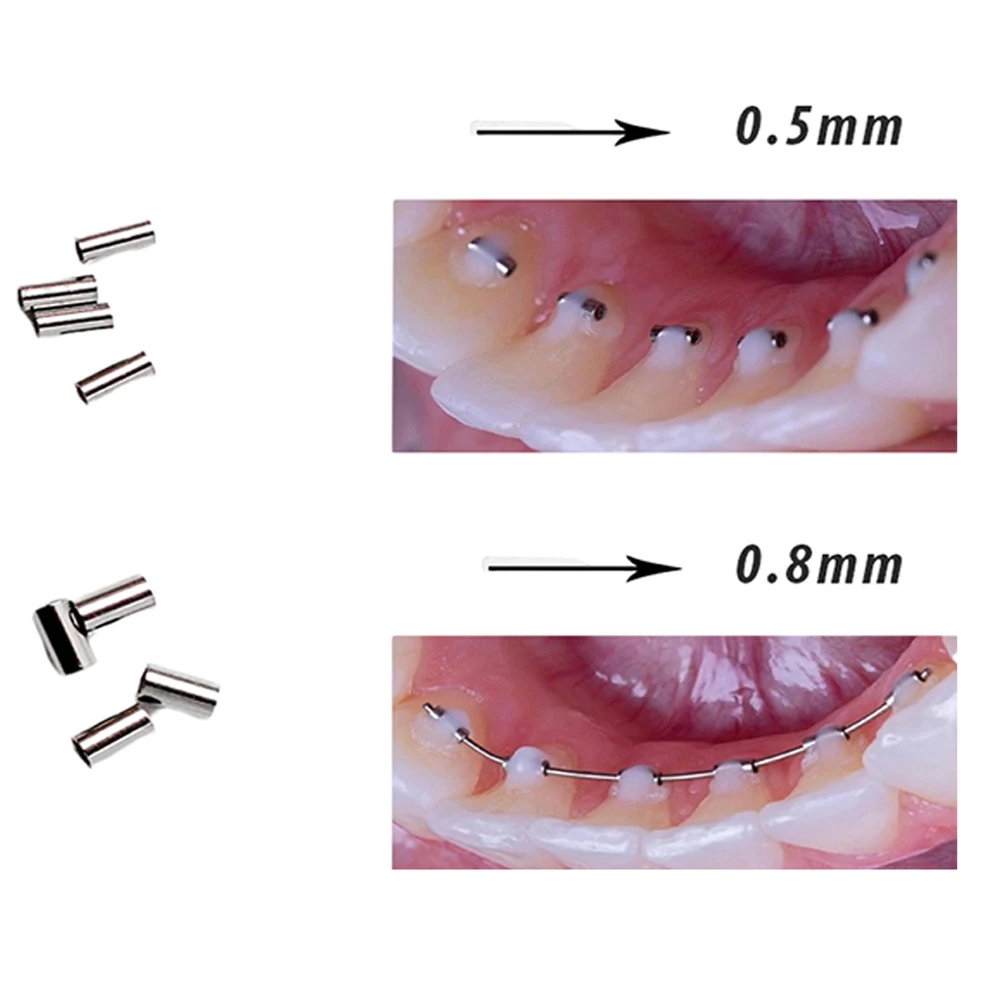 Drdent 10db Fogászati lingual Szállodai küldönc bondable Rozsdamentes Acél basenu crimpable Horog Fogászat orthodontic Élelmiszerek Fogászat