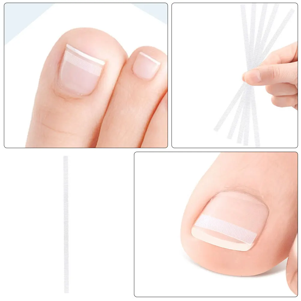 

5Pcs Breathable Ingrown Toenail Correction Strips Transparent Nail Care Strip Big Toe Treatment Straightener Toenail Care