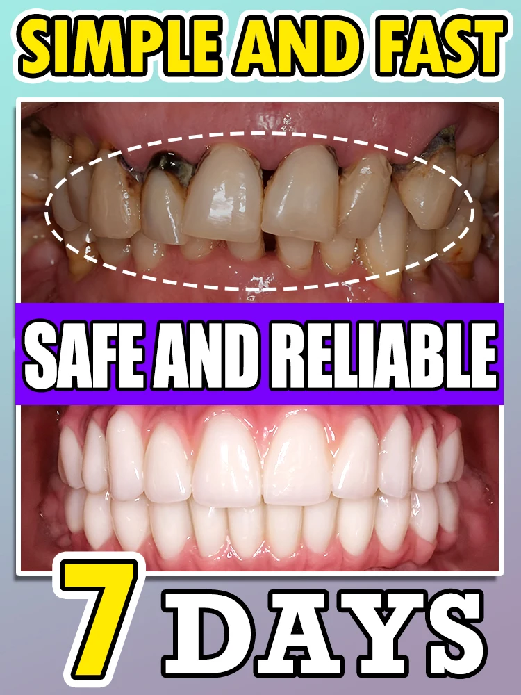 

Tartar removers dissolves tartar and eliminates stains