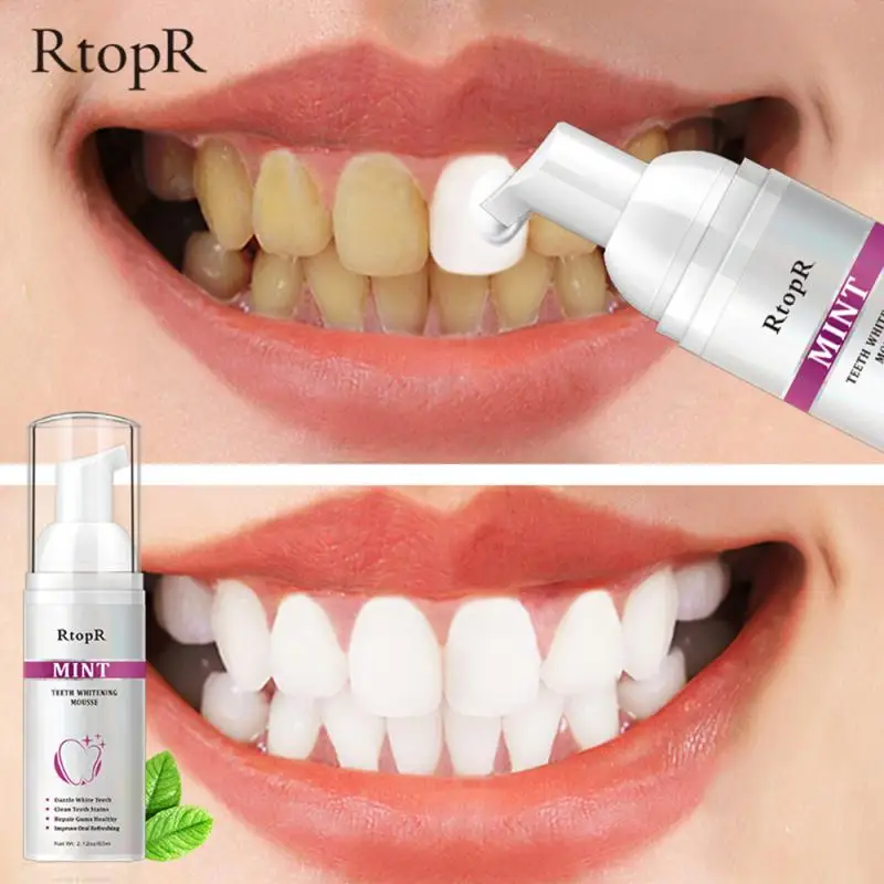 

Teeth Cleansing Whitening Mousse Whitening Teeth Remove Tooth Stains Clean Mouth Fresh Breath Mint Foam Portable Toothpaste