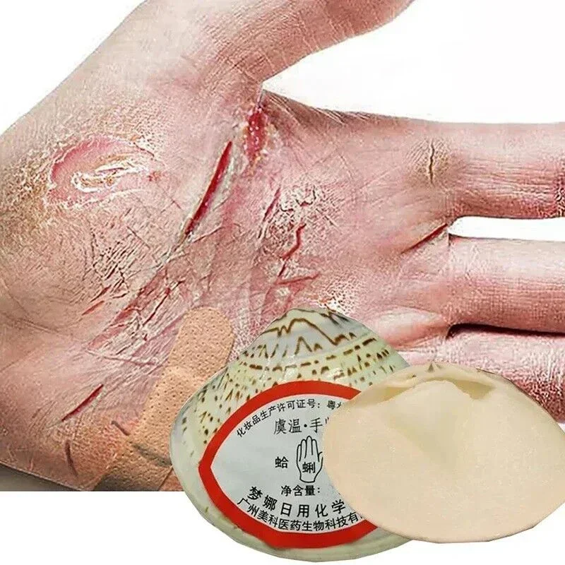 Traditional Chinese Clam Oil Anti Drying Cracked Repair Hand Cream Foot Heel Moisturising Ointment  Removal Feet Dead Skin Care