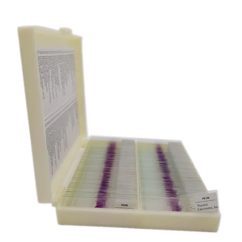 100Pcs Medical Human Pathology Set Pathological Prepared Slides