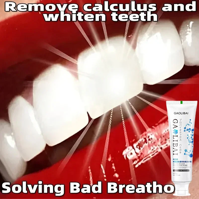 Whitening Toothpaste Dental Calculus Remover Mouth Odour Removal Bad Breath Preventing Periodontitis Fluoride Toothpaste