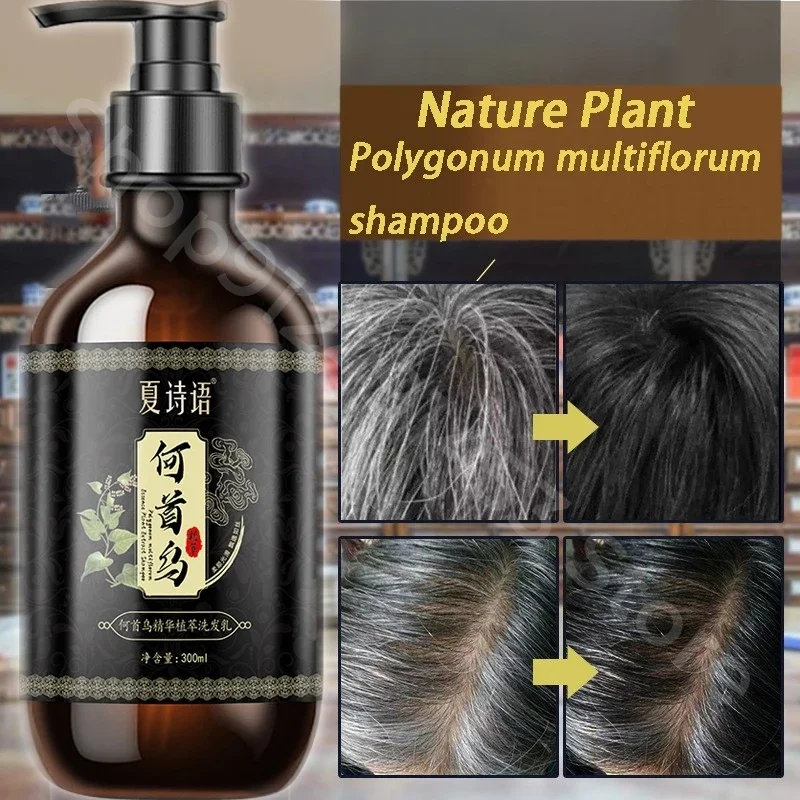 Black Ganoderma and Polygonum Multiflorum Plant Shampoo Repairs and Nourishes Damaged White Hair and Turns It Into Black Hair