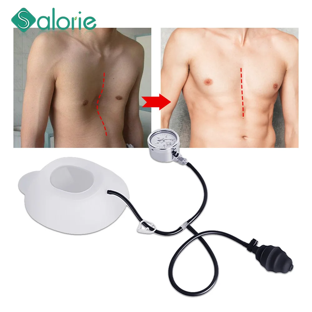 Pectus-Bagger-Vakuumglocke, Pectus-Bagger-Orthese-Klammer, Unterstützung für starale Depressionen, versunkene Brust – körperliche Brustkorrektur