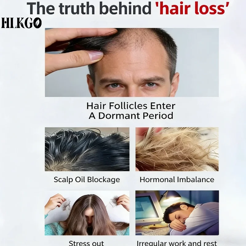 

Усовершенствованная лазерная шапка для роста волос Advanced Coverage 96, лечение LLLT при андрогенетической алопеции, алопеции ареаты, фиброзной алопеции лобной области