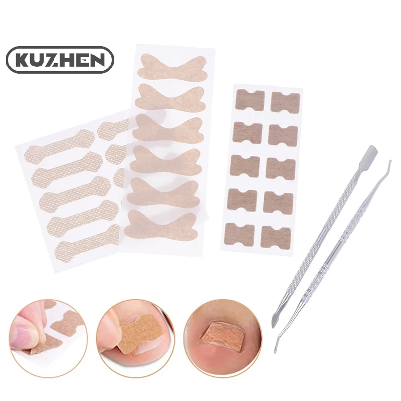 10Pcs Ingrown Toenail Correction Sticker Set Adhesive Toenail Patch Elastic Nail Treatment Corrector Sticker Foot Care Tools