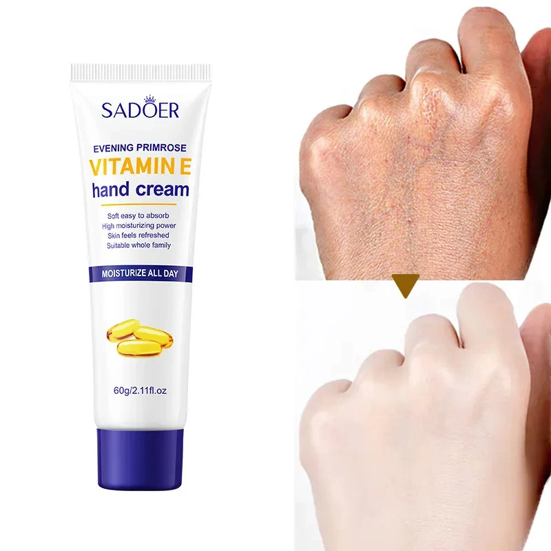 Anti-crack Whitening Hand Cream Wrinkle Removal Prevent Dry Cracked Rough Herbal Extract Smooth Skin Care Beauty Cosmetics