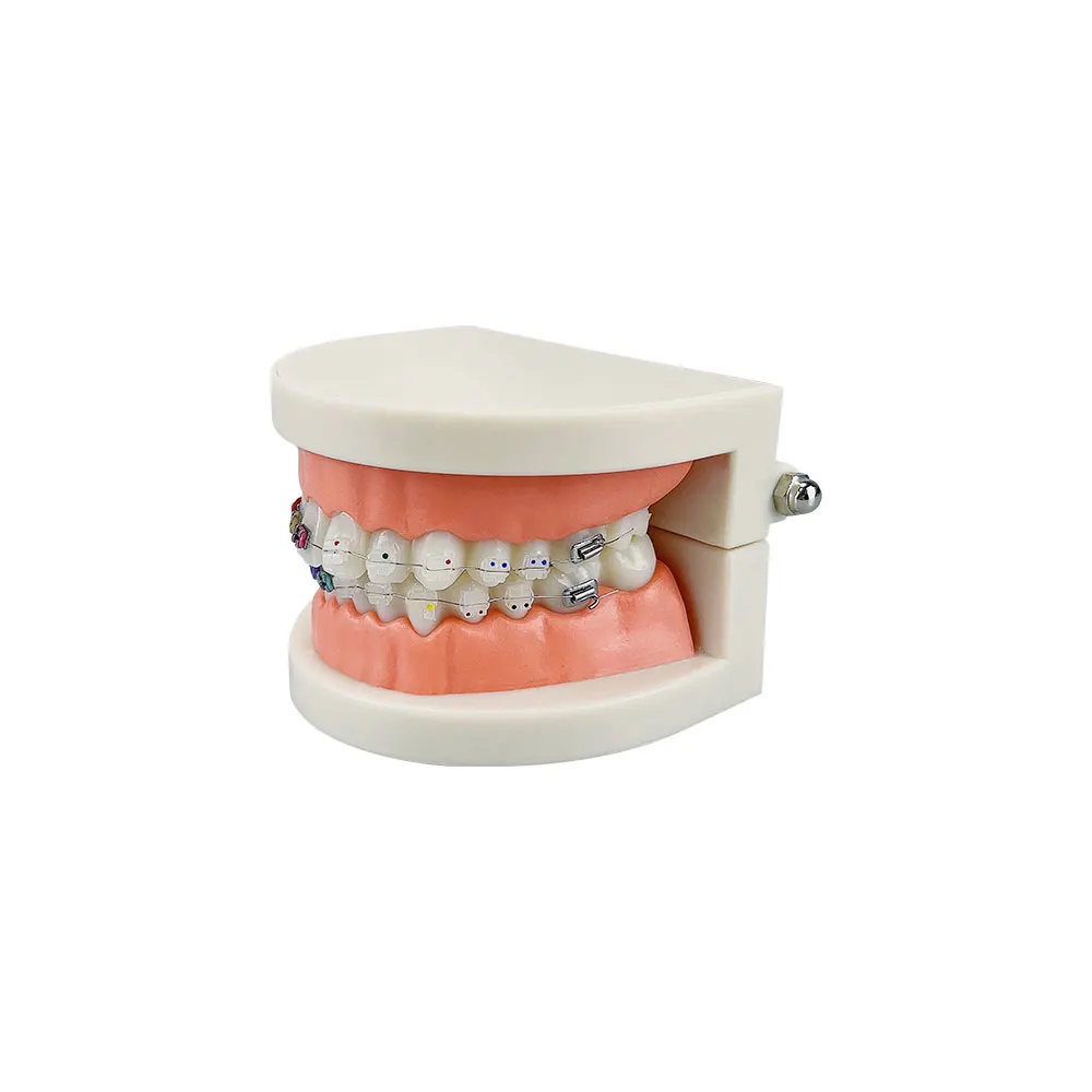 Modelo ortodôntico dental com suporte de cerâmica de metal arco fio tubo bucal ligadura laços tratamento dos dentes typodont ferramentas odontológicas