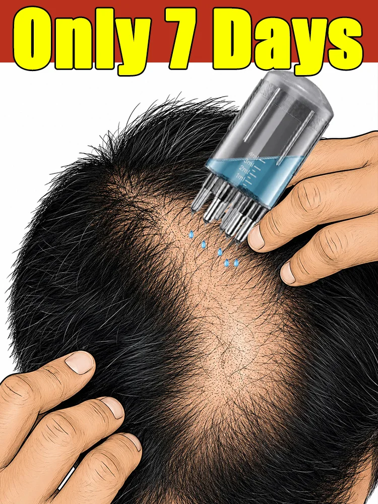 2026 The Dormant Hair Follicles Awaken, and the Head Becomes More Luxuriant