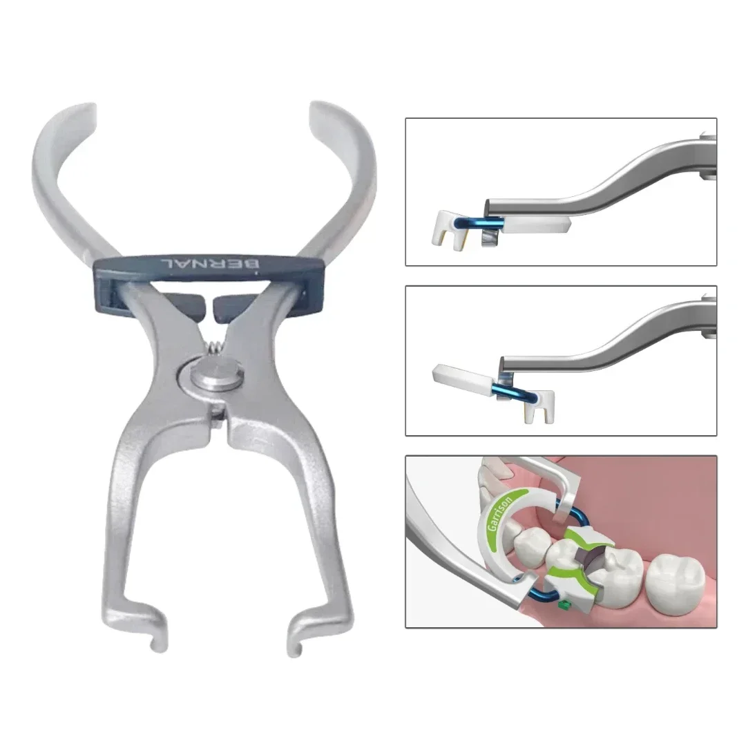 Matrix Ring Forceps Placement Plier Premium, Strong Separator Clamping Rings Fits Garrison
