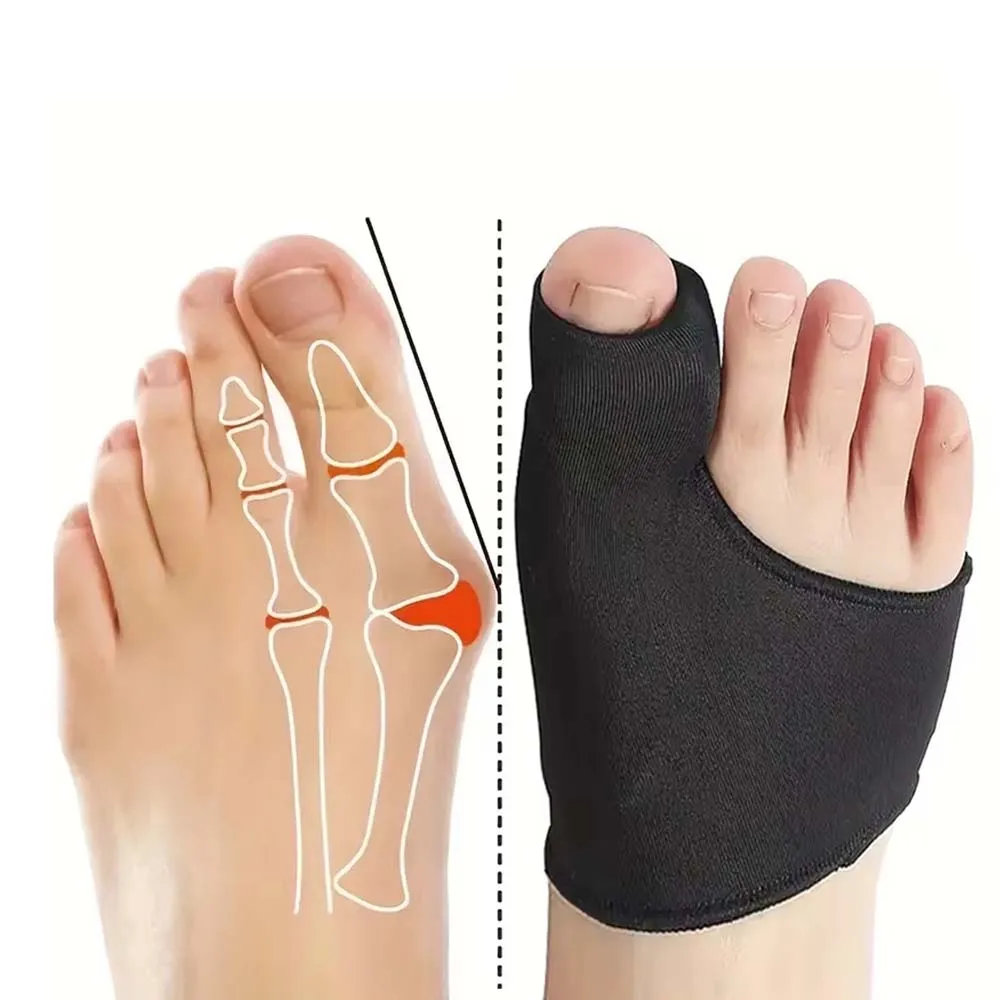 Hallux Valgus Corrector Palm Covers for Maximum Comfort, 1 Pair of Soft Feet Covers, Big Toe Splitter