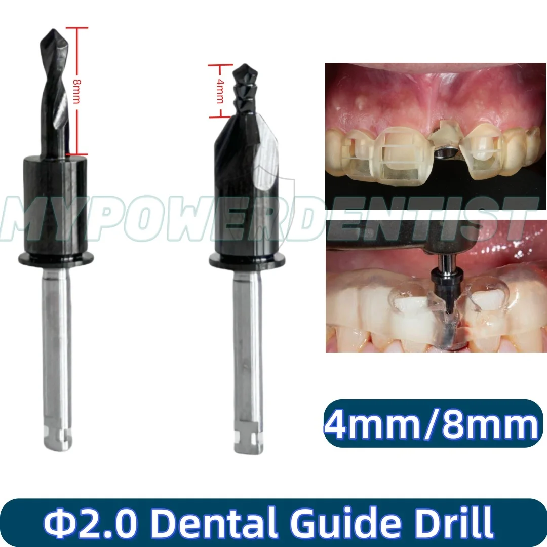 Dental Guide 2.0 Drill Digital Pilot Guide Implant Drill DLC Coated Length 4mm/8mm