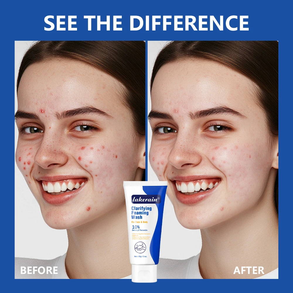 Thumbnail 2 - #48 Latest Body Cleansers Offers