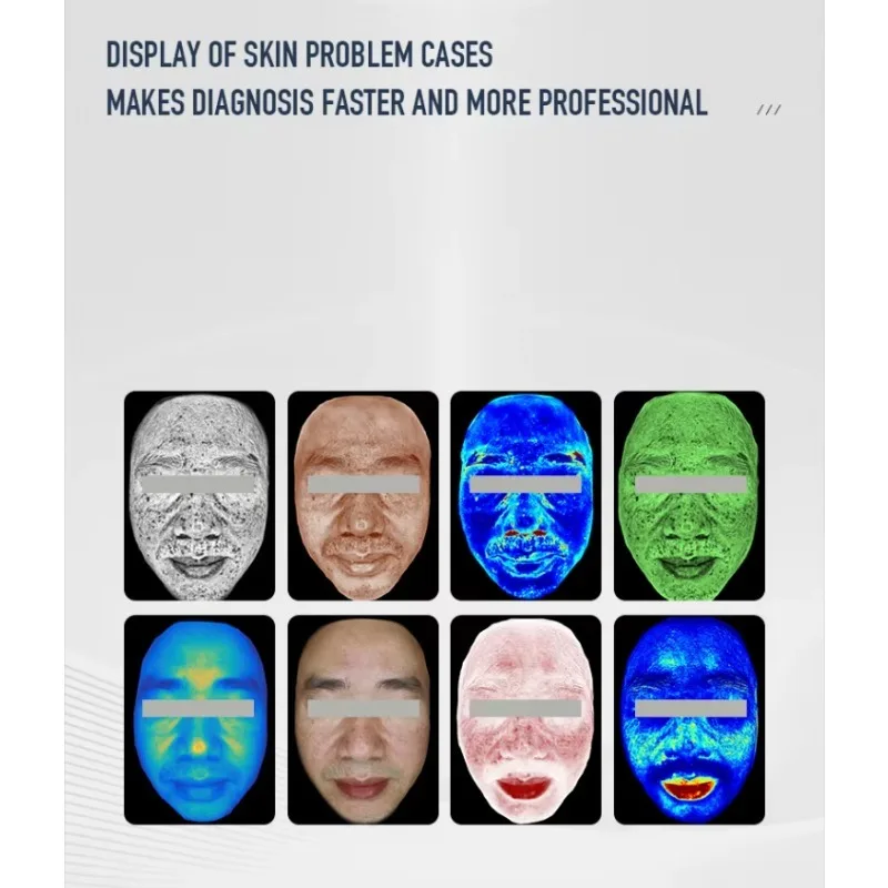 เครื่องวิเคราะห์หนังศีรษะและผิวหน้า 2 in 1 เทคโนโลยีใหม่ล่าสุด พร้อมระบบสแกน 3 มิติ AI