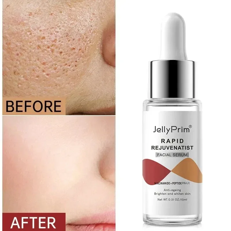 Pore Shrinking Face Serum Remove Dark Spots Face Whitening For Glowing Niacinamide Hyaluronic Acid Collagen Essece Skin Care