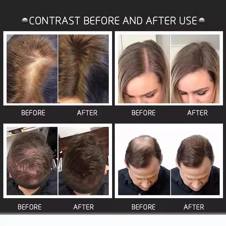 بودرة ألياف الشعر 27.5 جرام مقاومة للرياح للاستعمال مرة واحدة من الألياف السميكة لملء خط الشعر