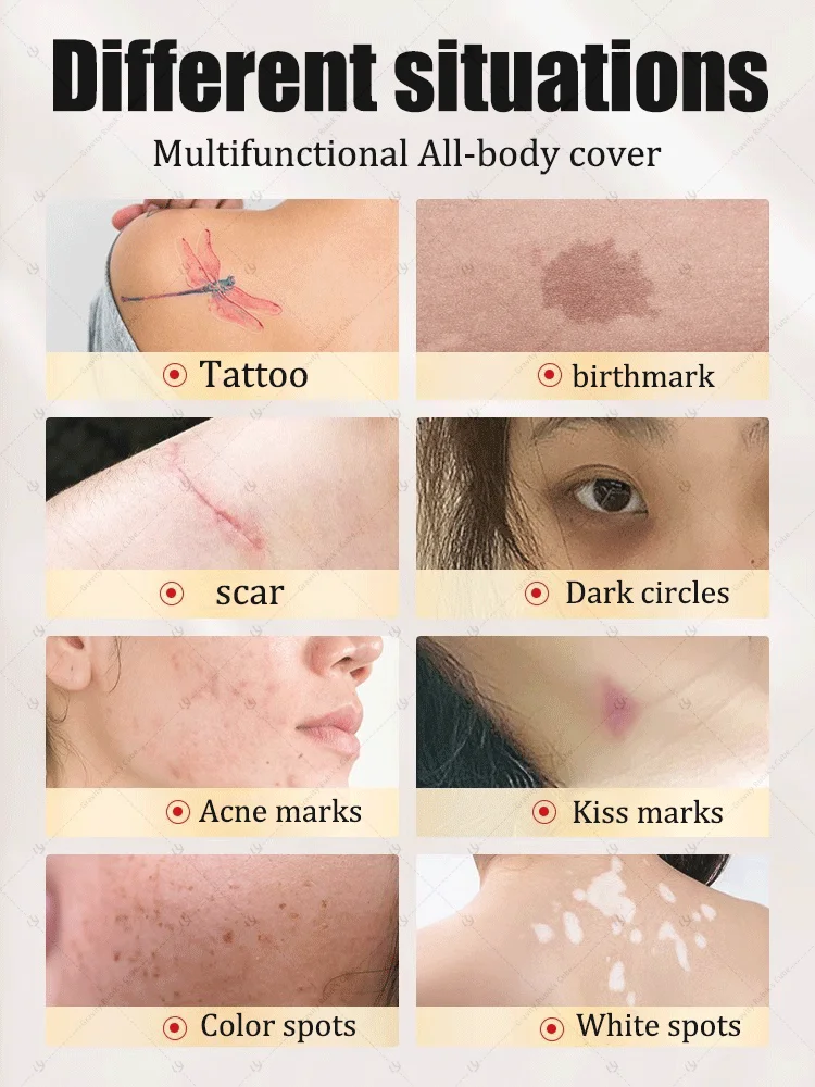 Il tatuaggio scompare e non può vedere