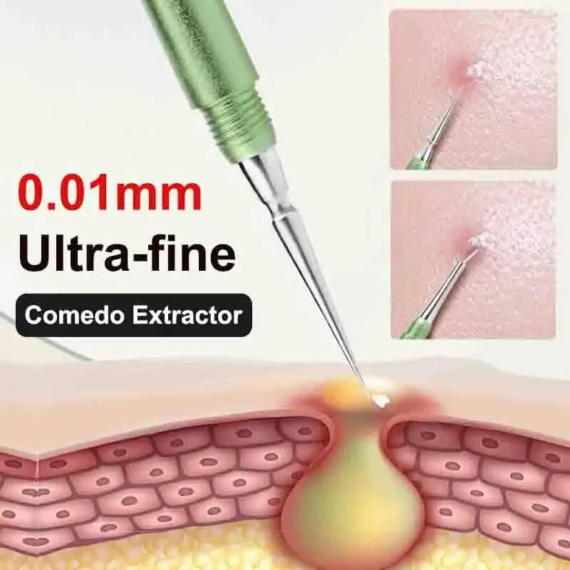 Extracteur de points noirs, comédon, acné, boutons, imperfections, aiguilles en acier inoxydable, outils pour enlever le visage, soins de la peau, nettoyeur de pores