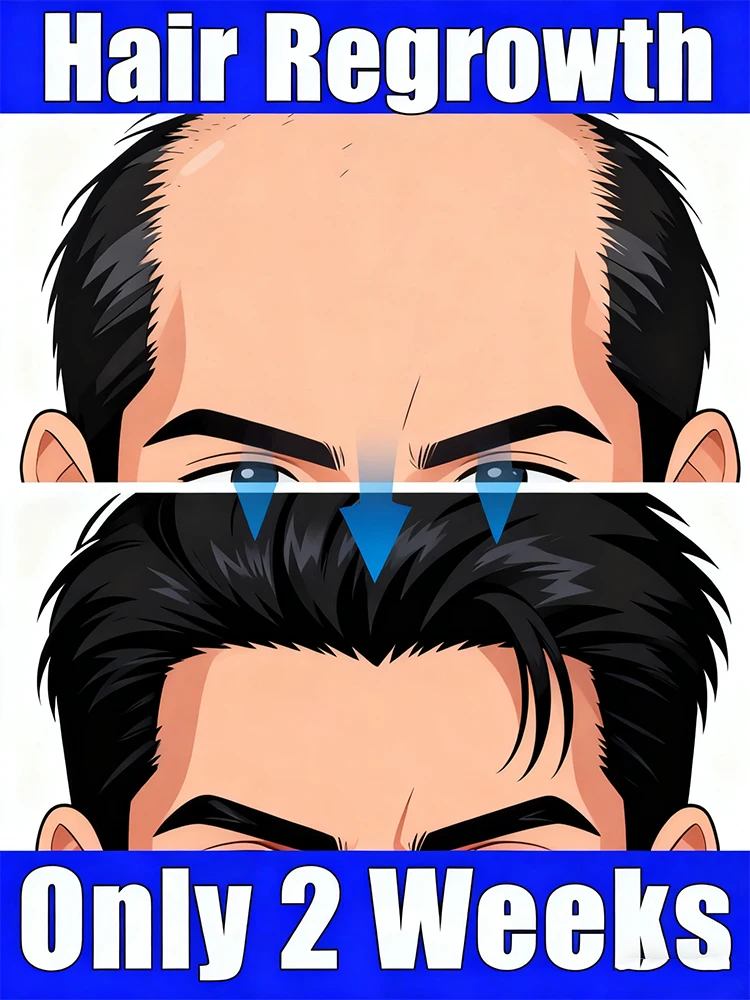 

Не волнуйтесь о всех видов выпадения волос, уход за нежным эфирным маслом, которая поможет вам вооружением «Супер волосы» 1