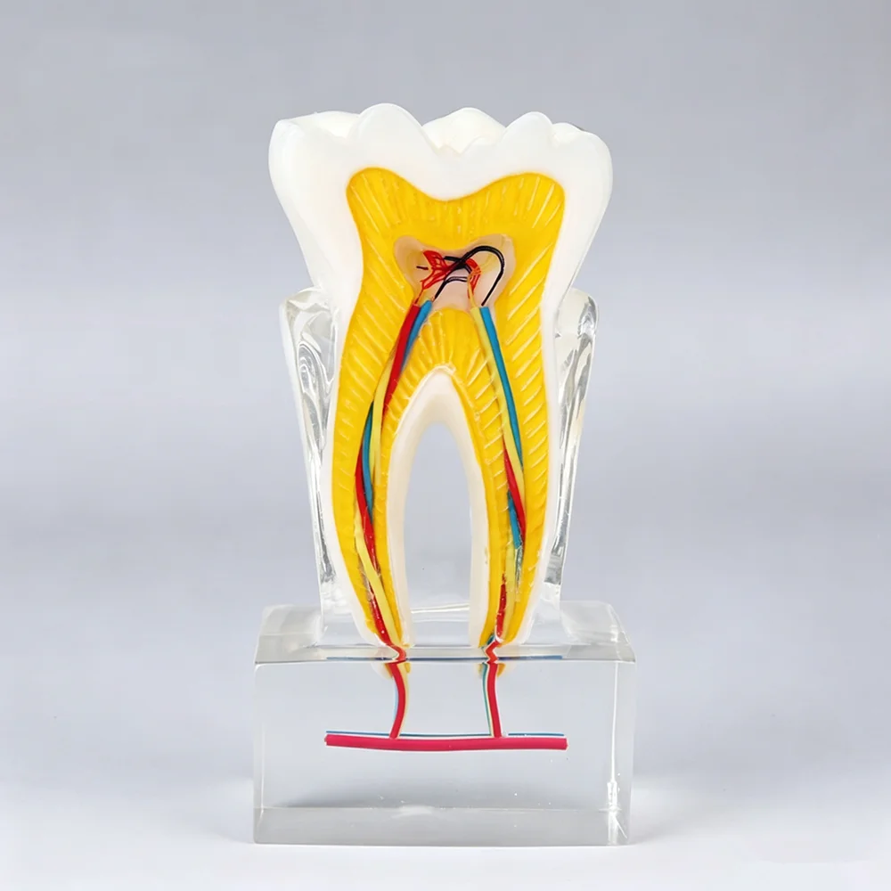 Dental Tooth Anatomy Model With Nerve Vessels Anatomical Cross Section Molar Model Endodontics Root Canal Demonstration Model
