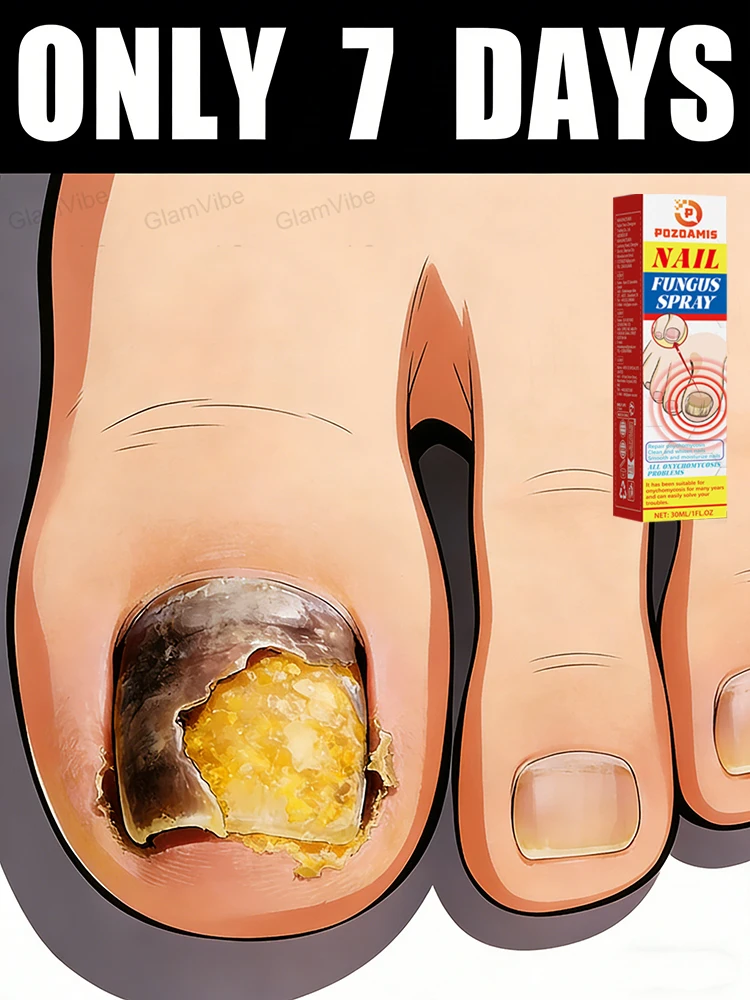 

Say Goodbye to Yellow Dullness, Grow Shiny Nails