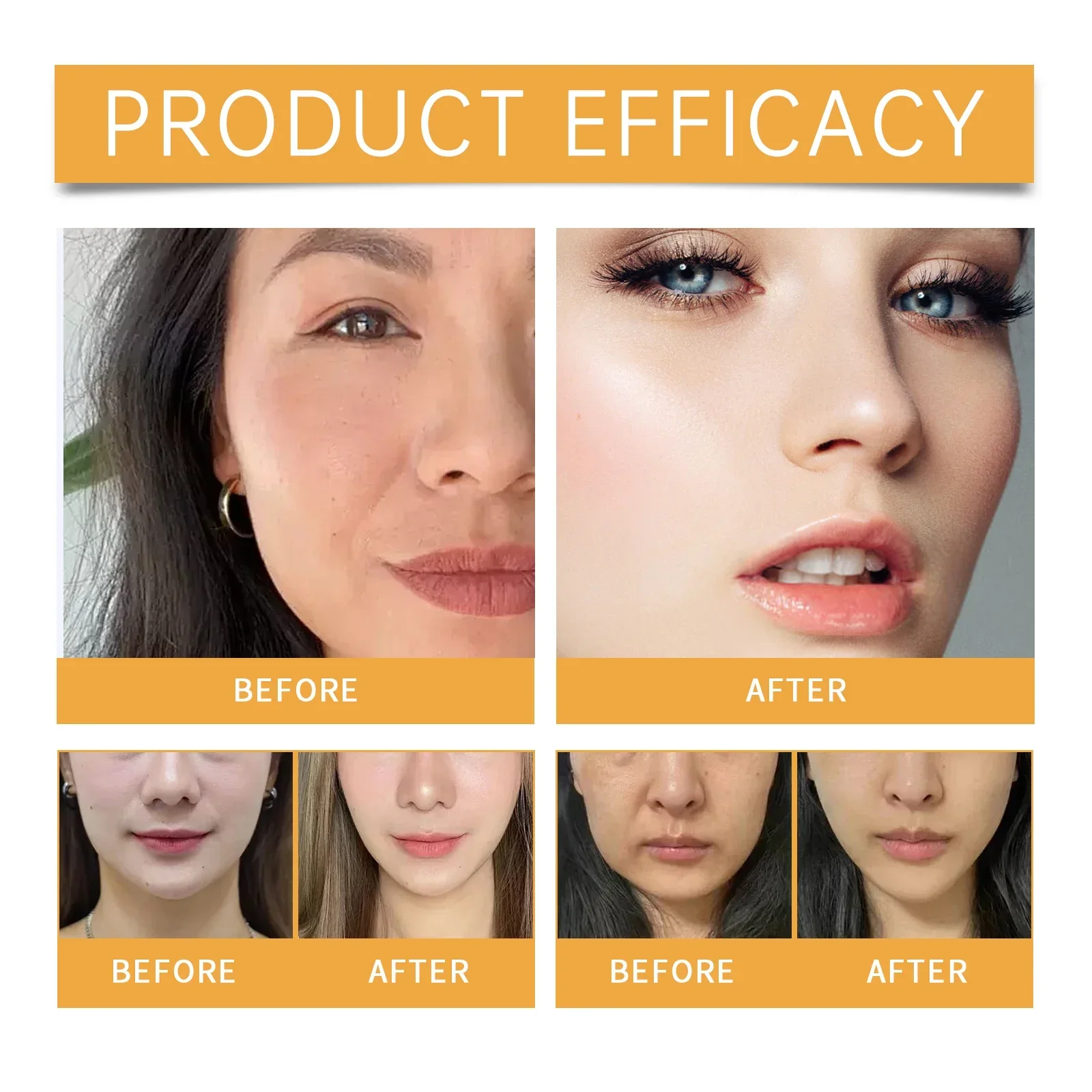 رقعة طيات الأنفية تحتوي على الكولاجين وحمض الهيالورونيك لشد البشرة وتتلاشى الخطوط الدقيقة قناع الوجه ، 2025 الأكثر مبيعًا