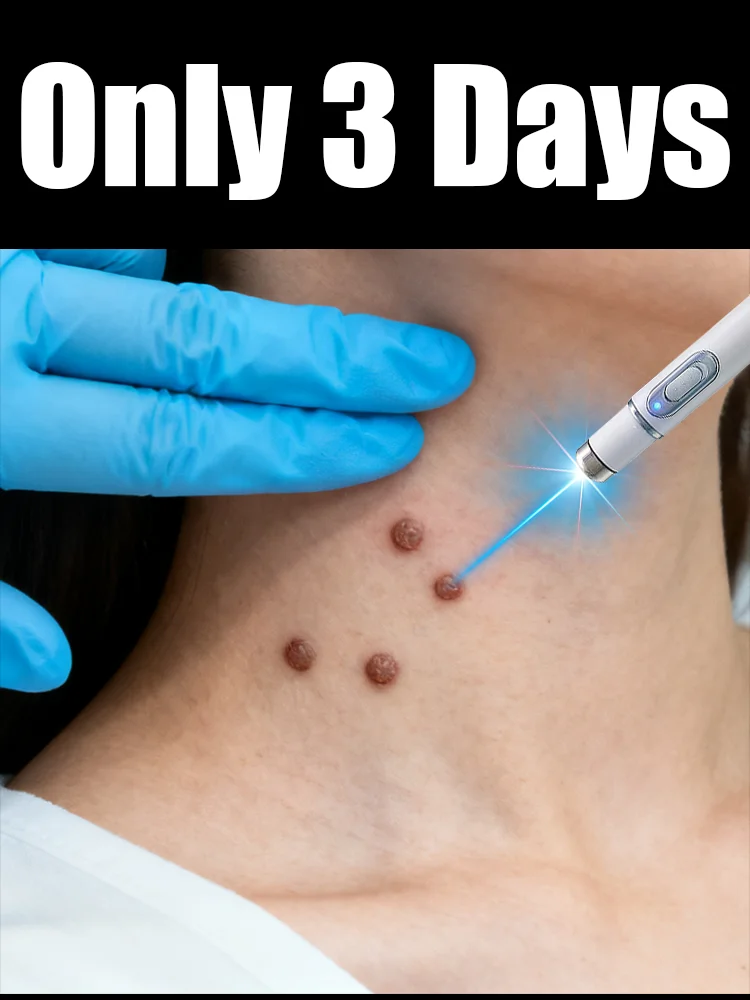 

The first generation of ⁱᵐᵖʳᵒᵛᵉᵈ ʷᵃʳᵗ ʳᵉᵖᵃⁱʳ ᵃᵍᵉⁿᵗ ʷᵃʳᵗ ʳᵒᵒᵗ ᶠᵃˢᵗ