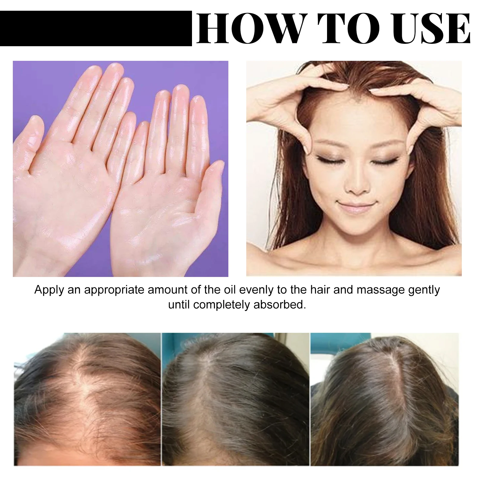 Fast Hair Growth Set Batana Oil Traction Alopecia Hair Mask Anti Break Loss Hair Growth Oil Baldness Treatment Hair Health Care - Image 3