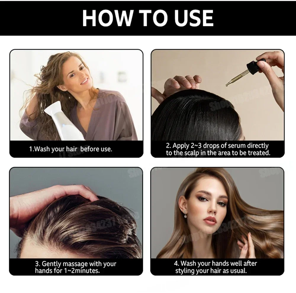 نمو الشعر للرجال والنساء، منتجات سريعة النمو، الزيوت الأساسية، الزنجبيل المضادة لتساقط الشعر، فروة الرأس، العناية بالشعر