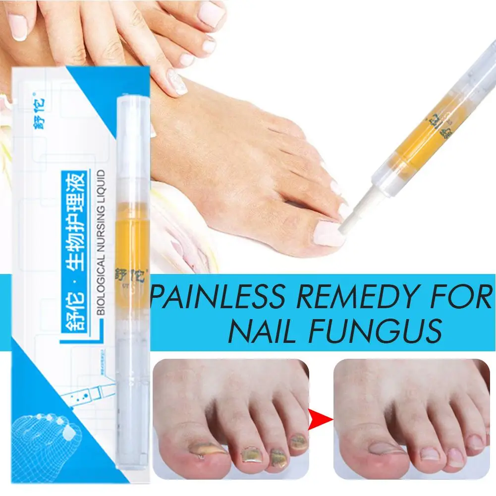 Nail Fungus Treatment Essence Serum Care Hand And Foot Repair Removal Gel Gel Anti-infective Nail 3ml Fungus Care Removal A4Z8