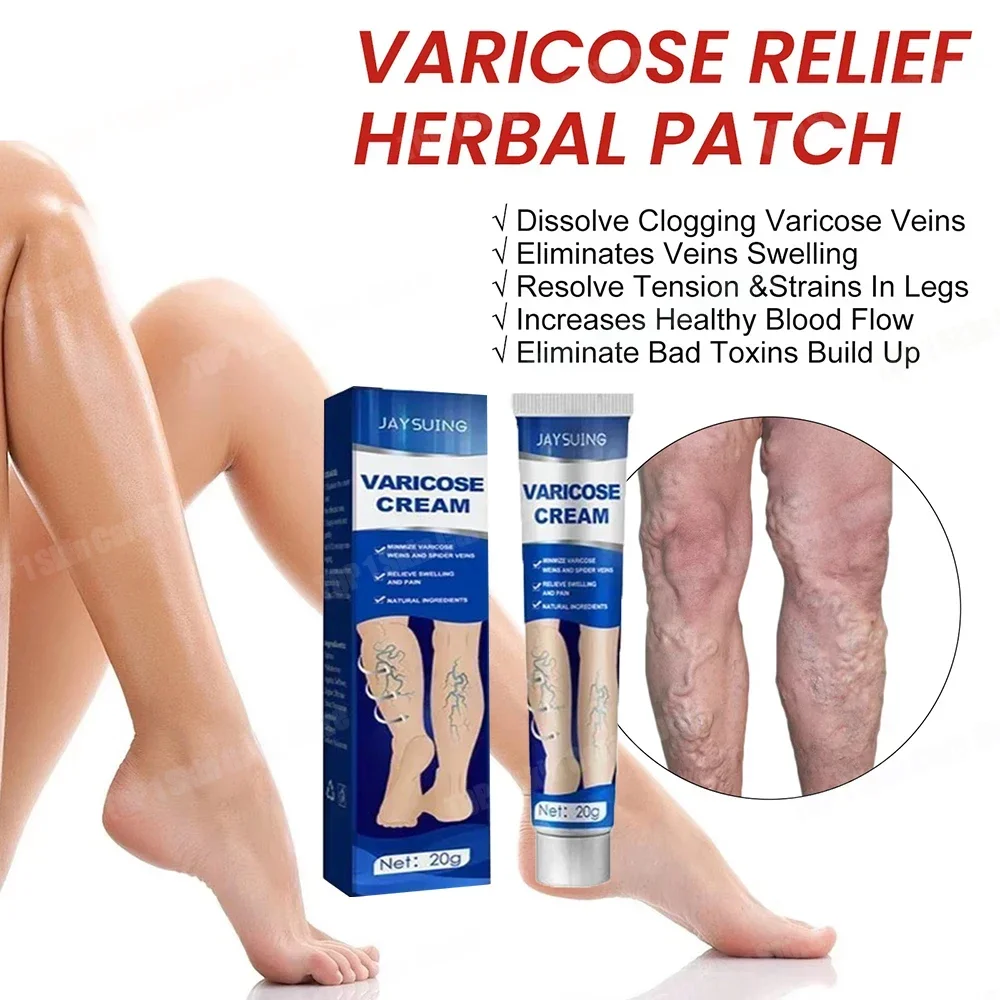 

Varicocele ointment, phlebitis ointment, spider leg ointment to relieve leg pain and numbness