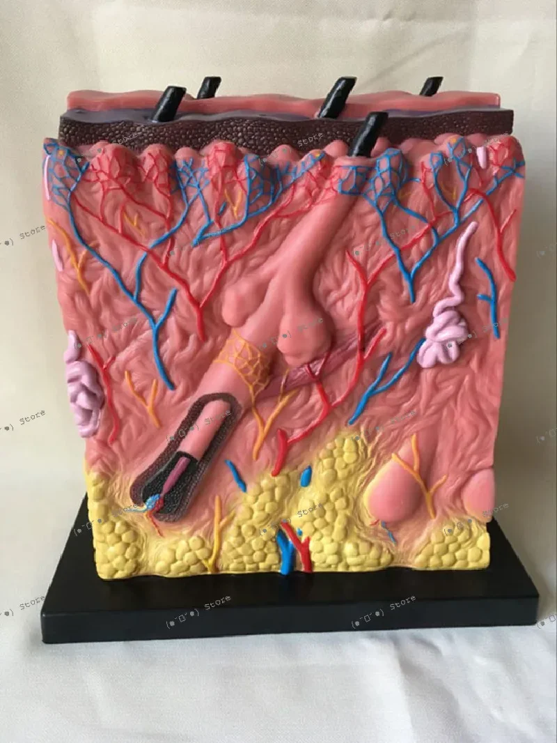 

skin structure anatomical model acne epidermis anatomical hierarchy structure suture dermis subcutaneous tissue