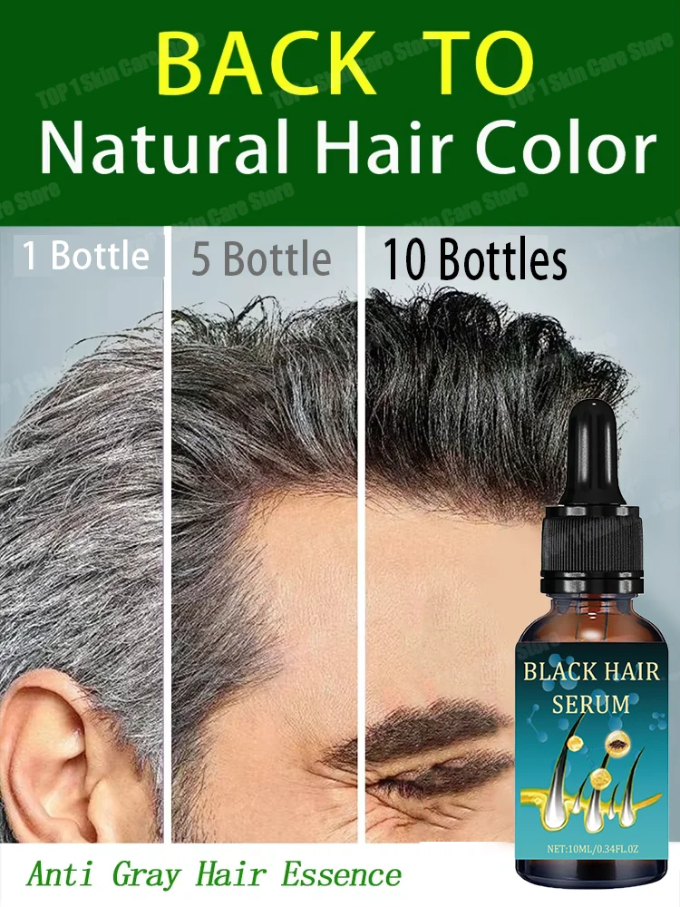 Anti-grey hair essence Serum treatment restore natural hair color and restore healthy White To Black care products