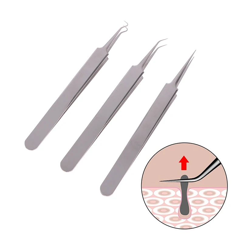 

1 pc Blackhead Clip Tweezers Beauty Tool Ultra-fine Cell Pimples Acne Needle Stainless Steel Cleansing Tweezer