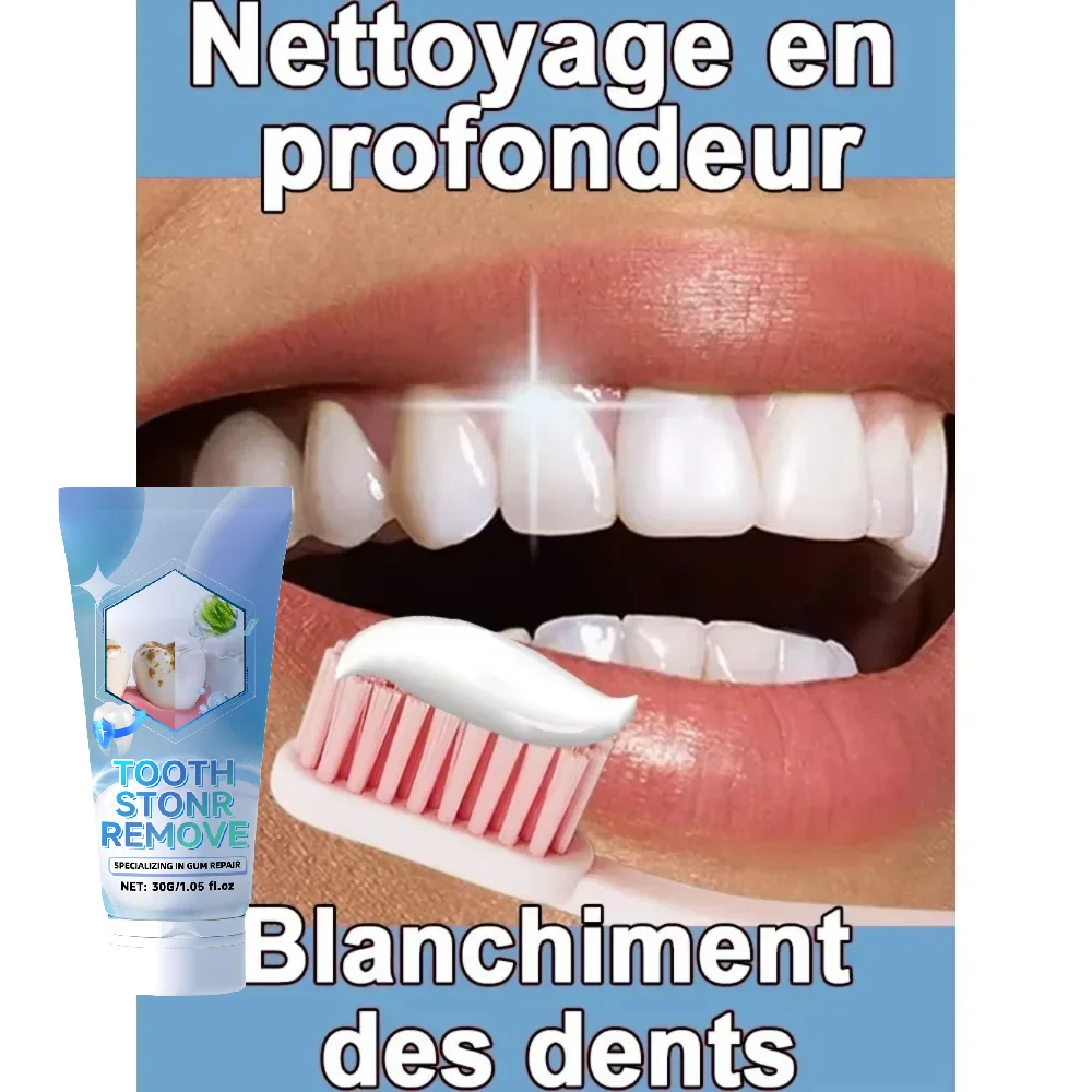 إصلاح الأسنان، ويمنع تساقط الأسنان، وإزالة لوحة الأسنان بشكل فعال #2