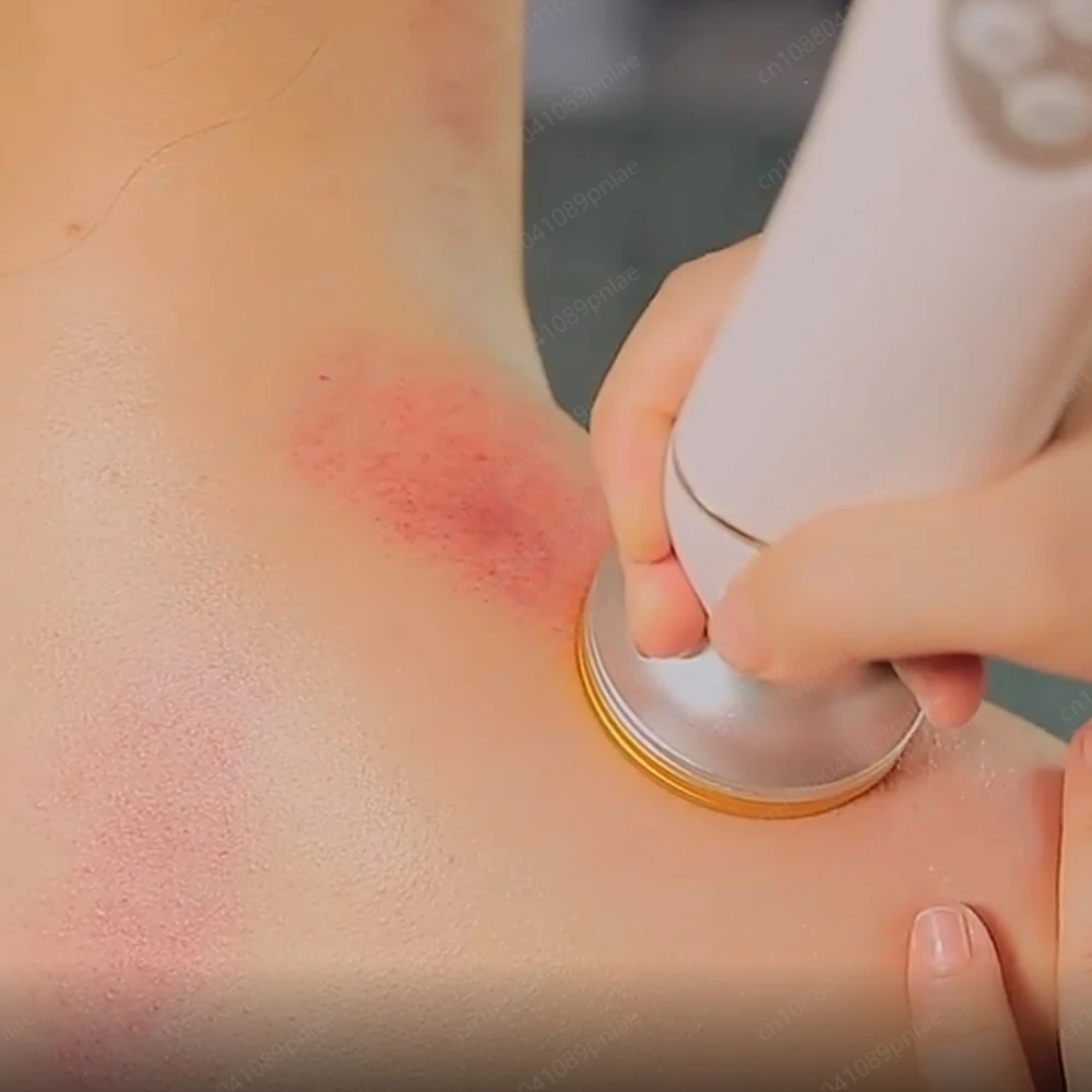 High-Quality New Electric Cupping Machine for Body Face Therapy Fatigue Relief Tool