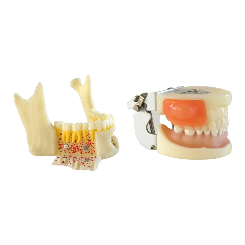 Dental Mandible Model with Hinge Buccal Anatomic Mandible Model Dentist Educational Demonstration Tool Dental Materials