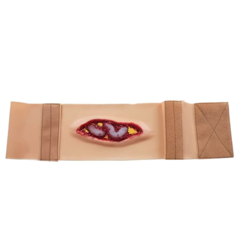 2025 New abdominal anatomical wound training model, a simulation model for medical teaching and training
