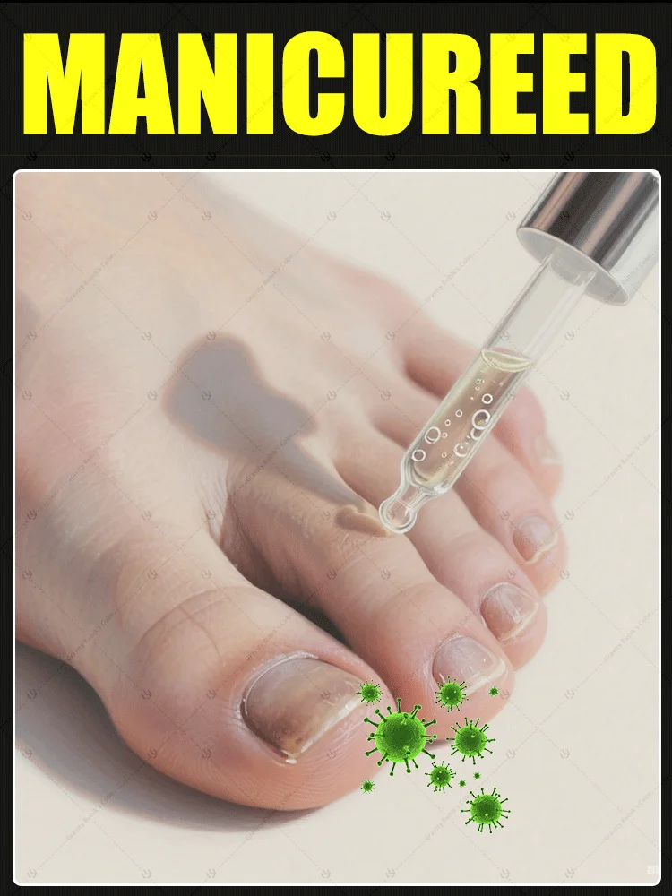

2025 Hot Sales Multi-functional Nail Repair, Nail Solutions for Discolored and Damaged Nails