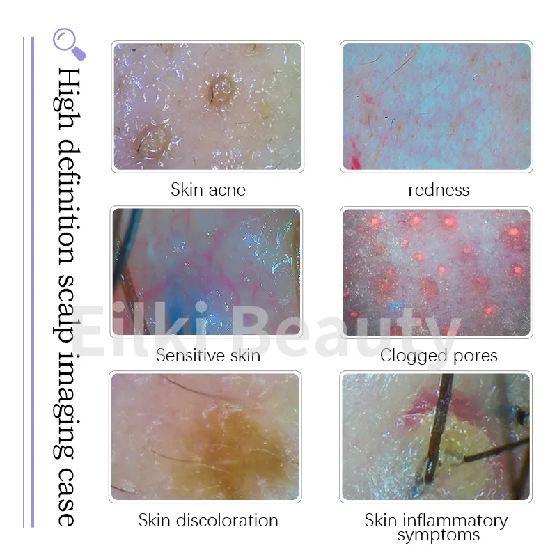 Nuovo 14 in 1 idroossigeno viso donne estetica attrezzatura di bellezza Hydra pelle che stringe la rimozione dei punti neri macchina per la pulizia del viso