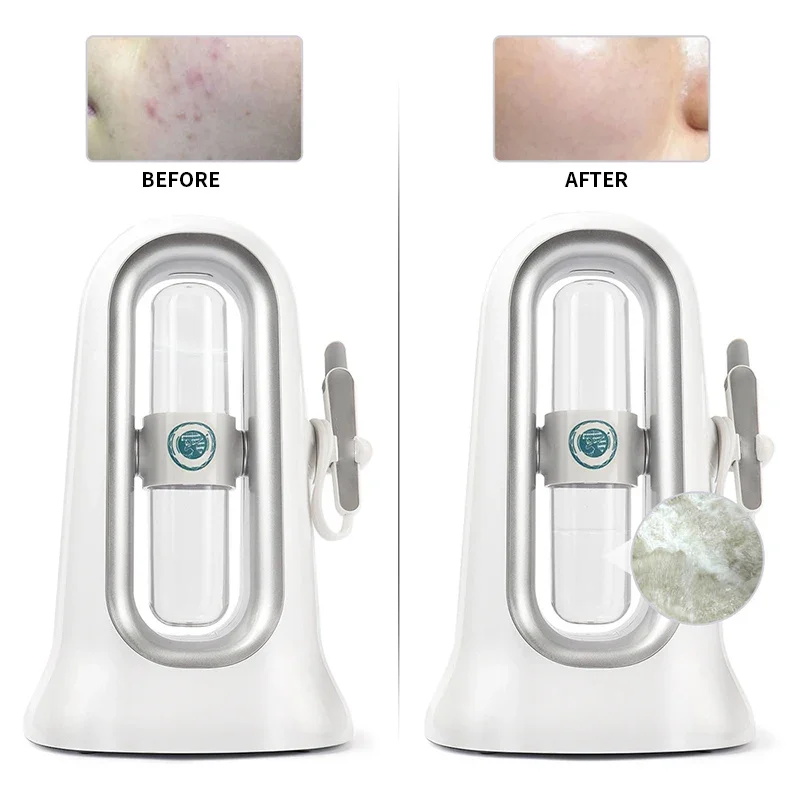 Micro Bubble Blackhead Removal Double Head Water Oxygen Jet Peeling Hydra Dermabrasion Aqua Peel Beauty Skin Cleansing Machine