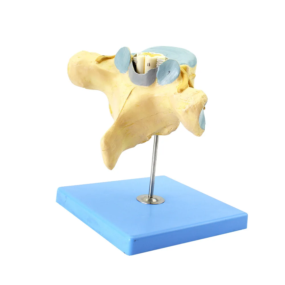 Magnified Model of Anatomical Structure of Human Lumbar Spinal Cord Cauda Equina, Human Nervous System, Medical Orthopedics
