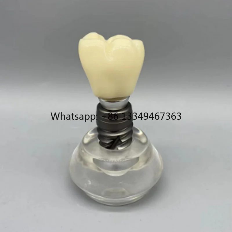 

Oral and Dental Education Medical Science Removable Transparent Enlarge Dental Model